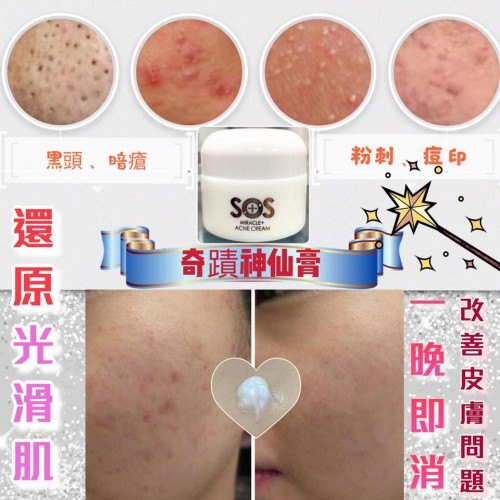德國Mmiracle+ SOS 去痘不留印神仙膏15ml (可用2-3個月)