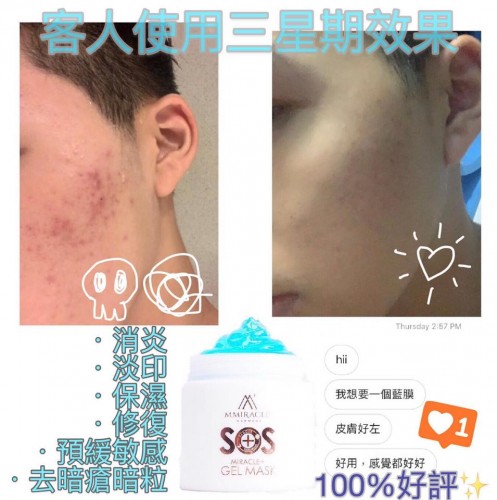 德國Mmiracle SOS 奇蹟藍膜 100g